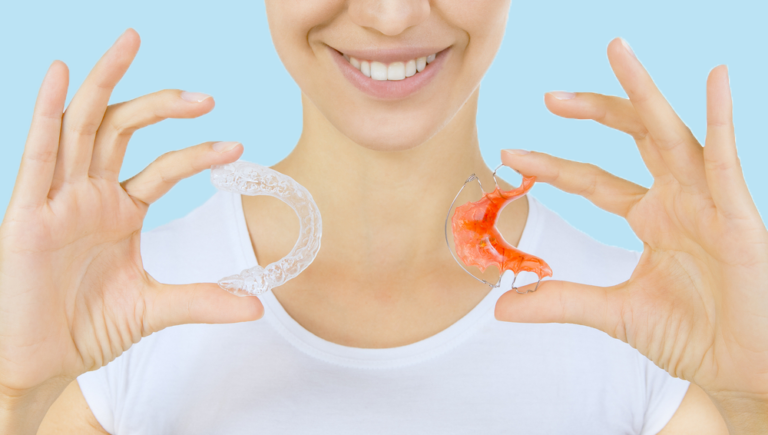 Orthodontic Retainers