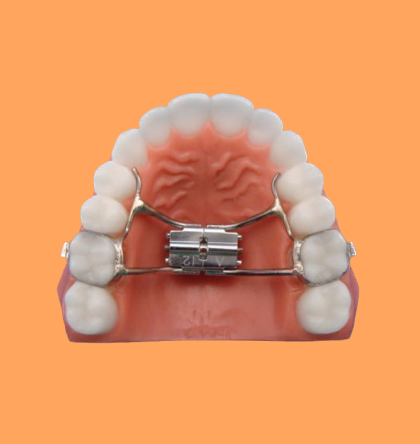 Palatal Expanders