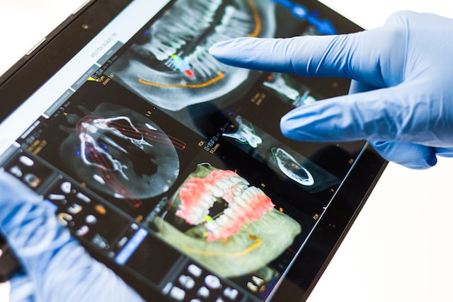 Orthodontist Holding Teeth Xray